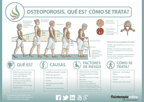 Infografía: Qué es la osteoporosis y cómo afecta al hueso