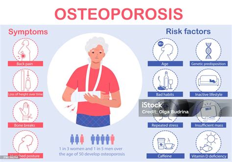 Infografía: Principales factores de riesgo para osteoporosis