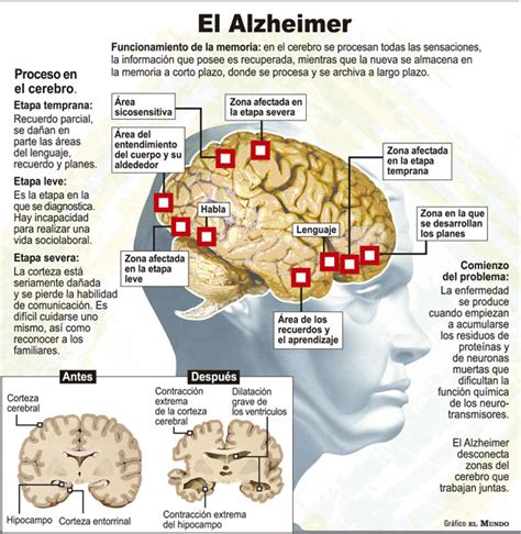 Esquema de las áreas cerebrales afectadas por la demencia