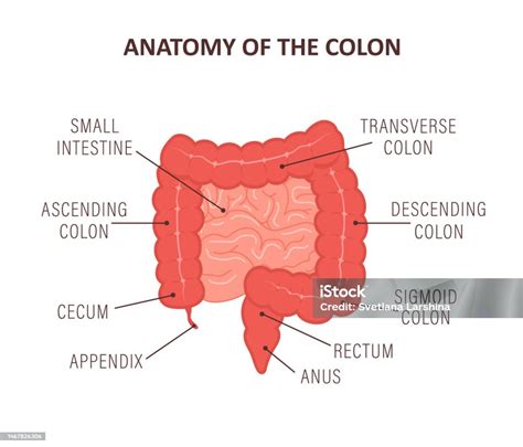Ilustración anatómica del colon y recto, señalando las áreas donde pueden aparecer tumores y los síntomas asociados (obstrucción en colon izquierdo, sangrado).