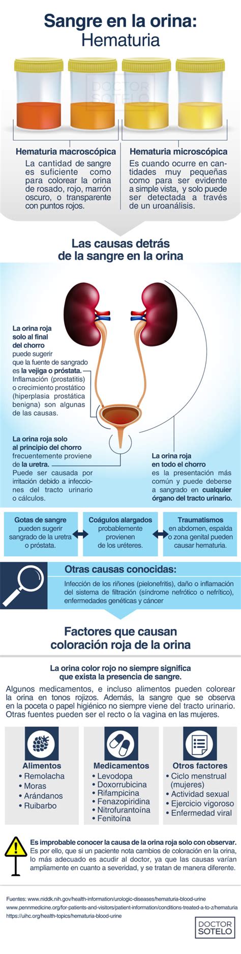 Infografía: Causas de la hematuria en adultos mayores