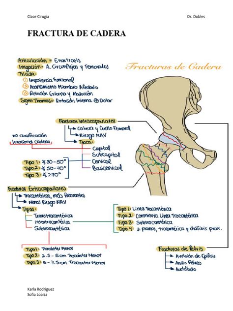 Infografía mostrando los diferentes tipos de fracturas de cadera