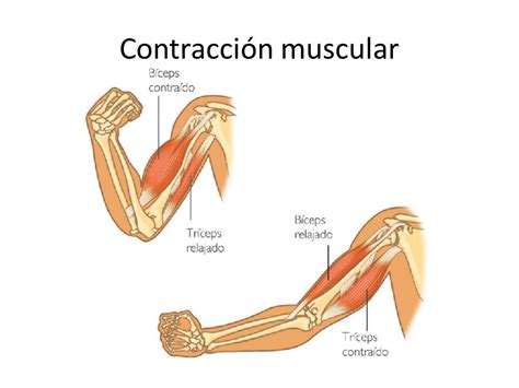 Esquema de contracción muscular o pierna con calambre