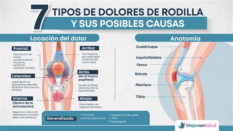 Infografía mostrando la localización del dolor de cadera (ingle, muslo, rodilla)