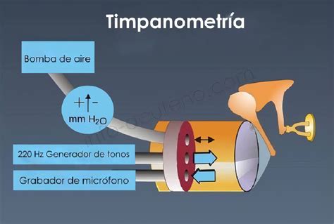 Diagrama que muestra el proceso de la timpanometría y sus posibles resultados.