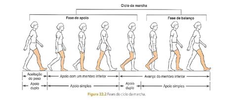 Gráfico comparativo: ciclo de marcha normal frente a los cambios biomecánicos en la marcha senil (acortamiento del paso y mayor base de sustentación).