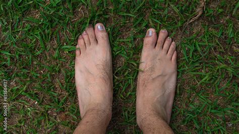 Foto de pies de persona mayor con decoloración violácea