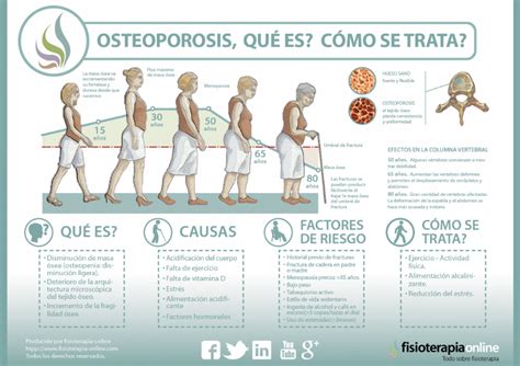 Gráfico o infografía que muestra los factores de riesgo de la osteoporosis.