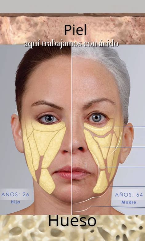 Infografía que muestra los cambios faciales comunes con la edad, incluyendo la flacidez de la piel, la prominencia ósea y la formación de arrugas.