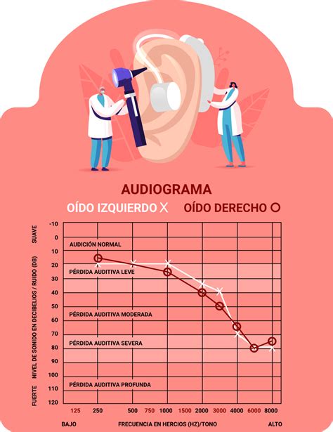Audiograma mostrando los diferentes grados de pérdida auditiva