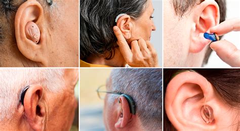 Tipos de audífonos e implantes auditivos