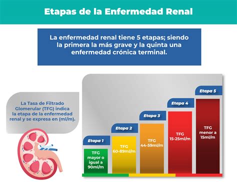 Infografía de las 5 etapas de la enfermedad renal crónica y sus valores de TFG