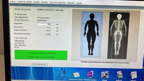 Diagrama: Métodos de medición de la composición corporal (Bioimpedancia, DEXA, pliegues cutáneos)
