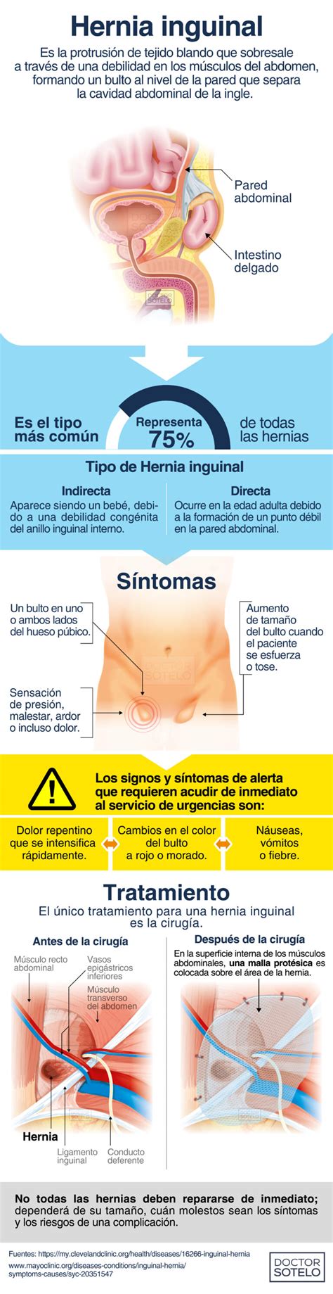 Esquema de las causas de la hernia inguinal en adultos mayores, incluyendo debilidad muscular y aumento de la presión intraabdominal