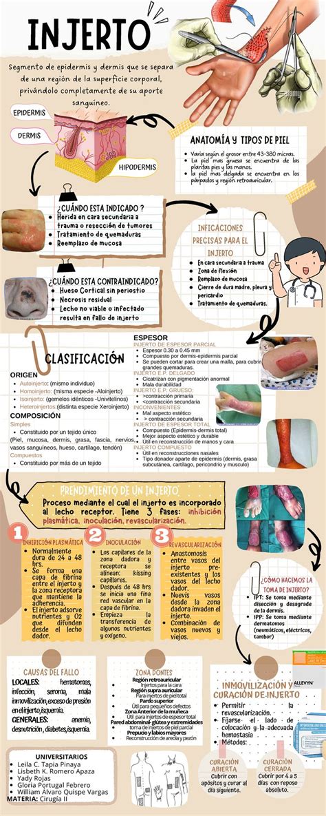 Infografía sobre los tipos de injertos de encía