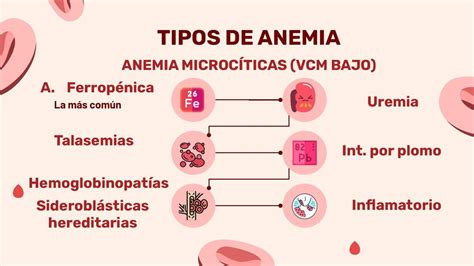 Infografía sobre los diferentes tipos de anemia y sus características.