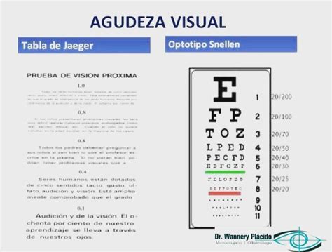 Gráfico ilustrativo de los diferentes grados de agudeza visual y su impacto en la percepción