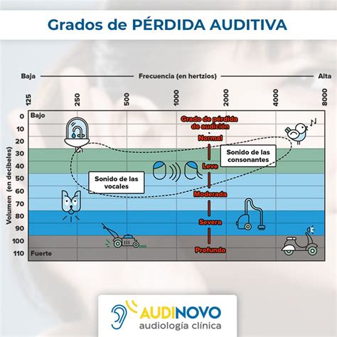 Esquema de las clasificaciones de la pérdida auditiva (leve, moderada, grave, profunda) en relación con los decibelios.