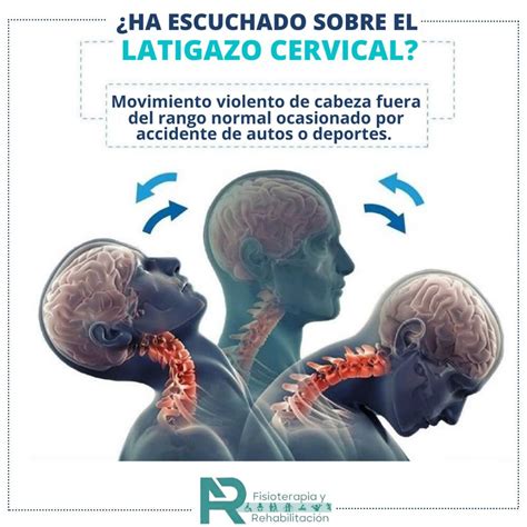 Esquema de las fases de un latigazo cervical durante un impacto trasero en un coche