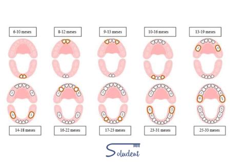 Gráfico ilustrativo del orden de aparición de los dientes de leche