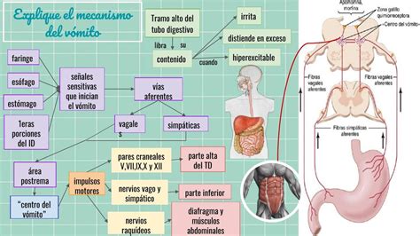 Diagrama de las complicaciones del vómito en el esófago