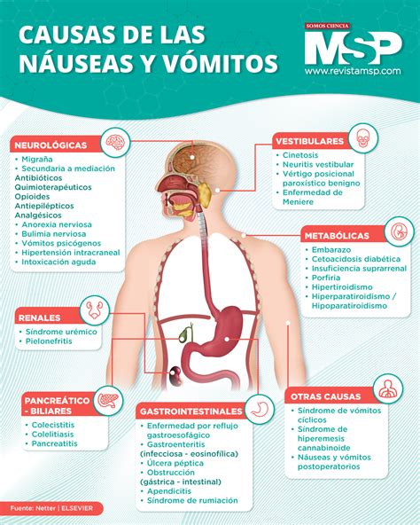 Infografía sobre los tipos de náuseas y vómitos relacionados con el cáncer