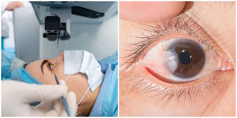 Diagrama que ilustra las causas comunes de la pérdida de visión como cataratas, glaucoma y degeneración macular