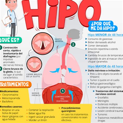 Ilustración detallada de técnicas caseras para aliviar el hipo