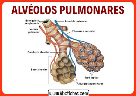 Esquema anatómico mostrando la inflamación de los alvéolos pulmonares en un paciente con neumonía.