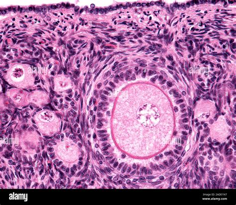 Micrografía de un ovario con folículos