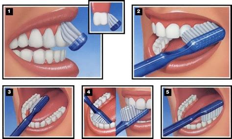 ilustración de técnicas correctas de cepillado y uso de hilo dental
