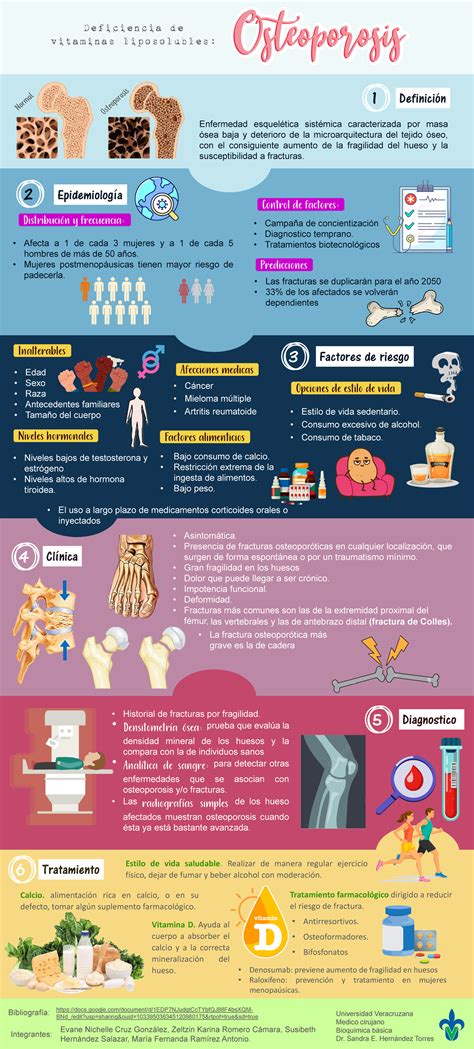 Infografía sobre osteoporosis y densidad ósea