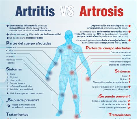 Infografía comparativa de síntomas y articulaciones afectadas en AR y PMR