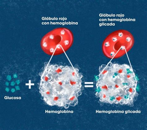 Ilustración de cómo el azúcar se adhiere a la hemoglobina en los glóbulos rojos