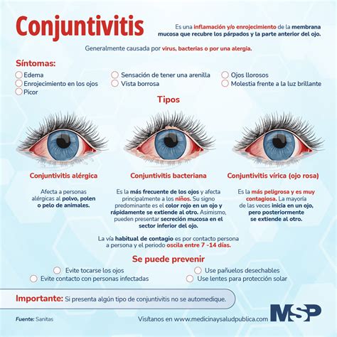 Infografía: Tipos de conjuntivitis y sus causas