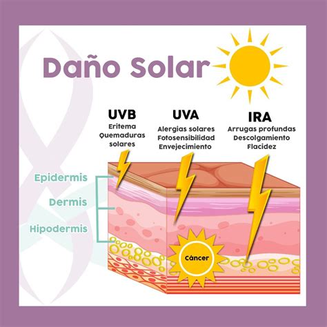 Ilustración mostrando los efectos del daño solar en la piel a lo largo del tiempo.