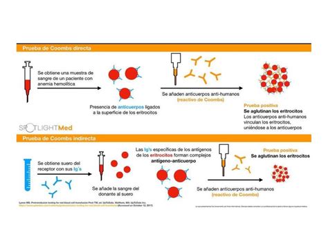 Diagrama de la prueba de antiglobulina directa (Coombs directo)