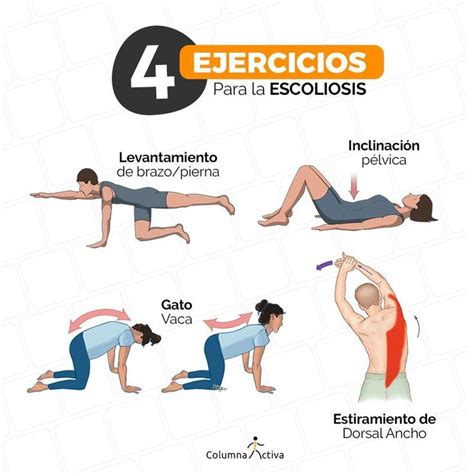 Foto de una persona realizando ejercicios de fisioterapia específicos para escoliosis.