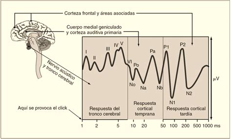 Esquema de la actividad eléctrica cerebral durante una convulsión