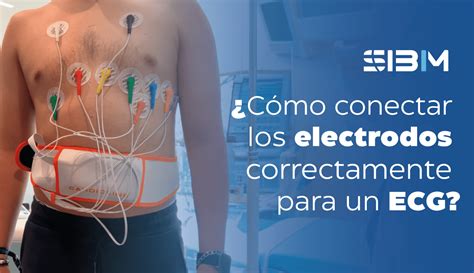 Diagrama de la colocación de electrodos para la medición de impedancia periférica