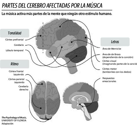 Infografía mostrando las áreas del cerebro activadas por la música