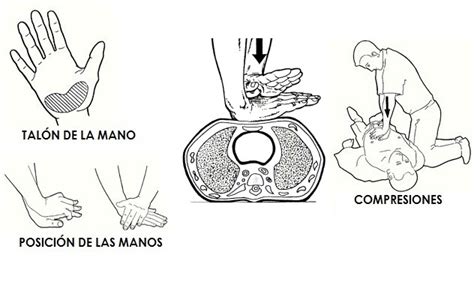 Ilustración de la posición correcta de las manos para compresiones torácicas en adultos