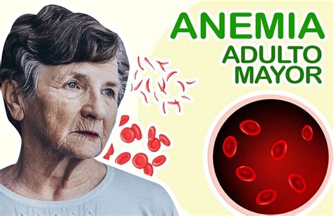 Esquema de las causas principales de anemia en adultos mayores