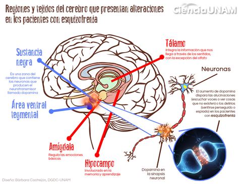 Esquema de las alteraciones cerebrales asociadas a la esquizofrenia
