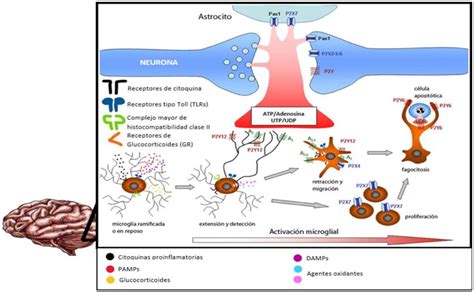Esquema ilustrativo que muestra la afectación multisistémica de la Neurofibromatosis en el sistema nervioso, huesos y piel.