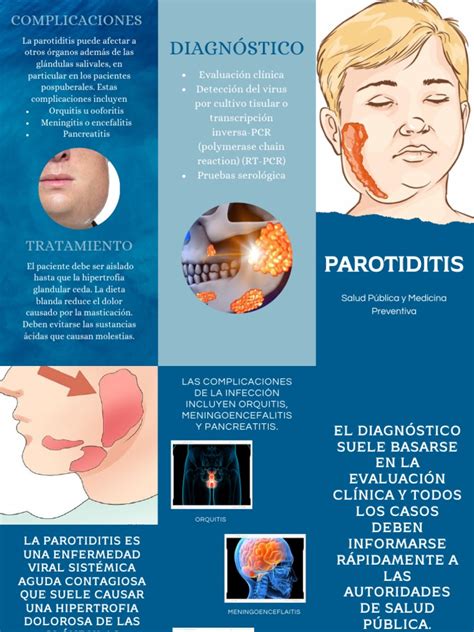 Infografía sobre las posibles complicaciones de la parotiditis en diferentes órganos