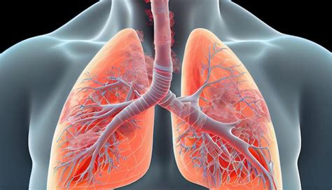 Esquema ilustrativo que muestra la inflamación de las vías respiratorias en comparación con un pulmón sano.