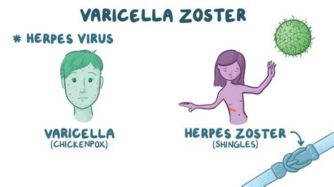 Esquema de la reactivación del virus varicela-zóster en el ganglio nervioso