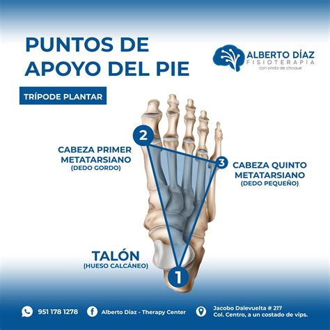 Esquema de un pie y sus puntos de apoyo al caminar