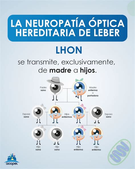 Infografía sobre el Síndrome de Leber y sus efectos en el nervio óptico
